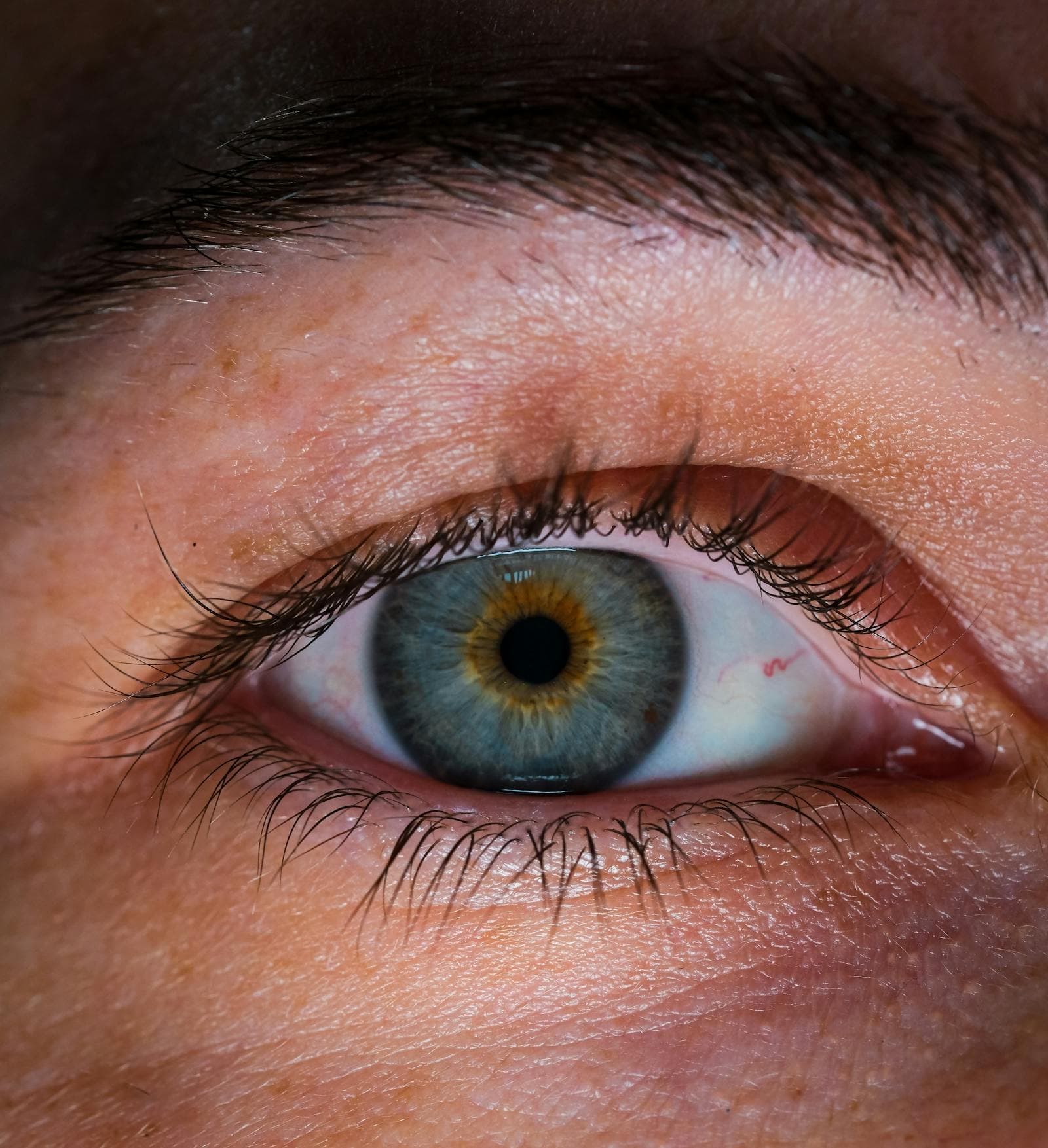 Cataracts: Symptoms, Causes, and Modern Treatment Options