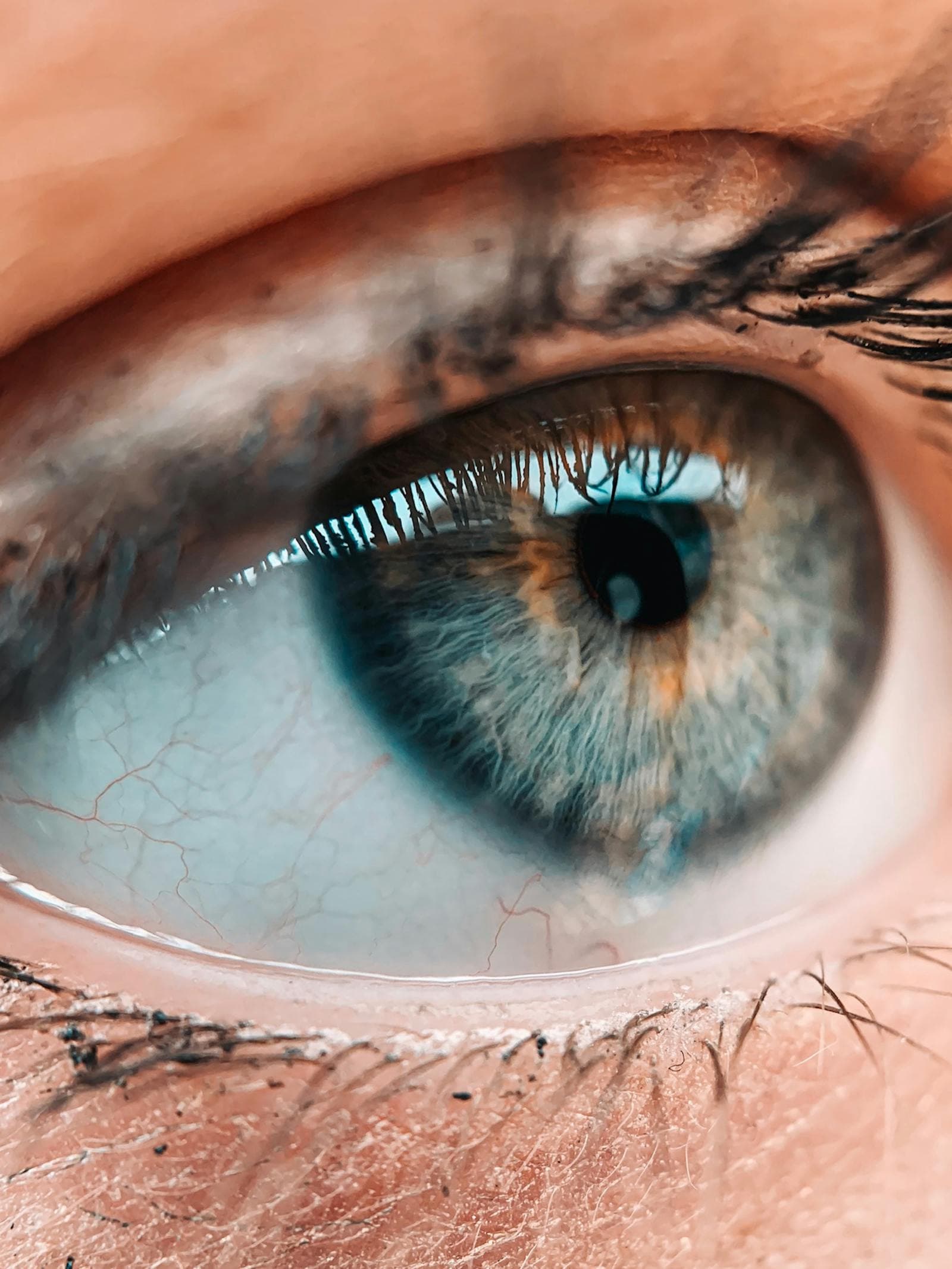 Early Signs of Diabetic Retinopathy You Shouldn't Ignore