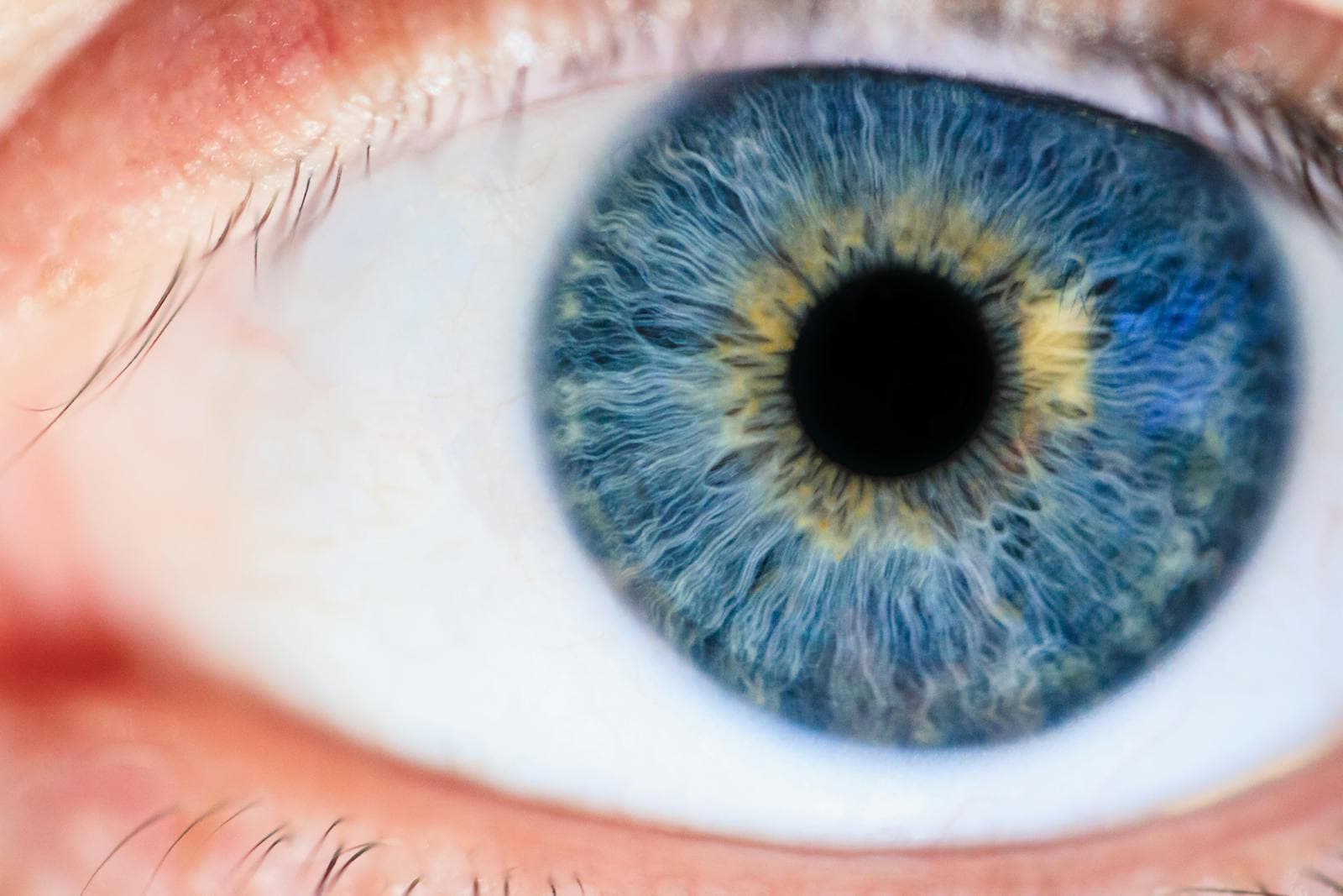 Are Eye Floaters Dangerous? What Every Hyderabad Resident Should Know