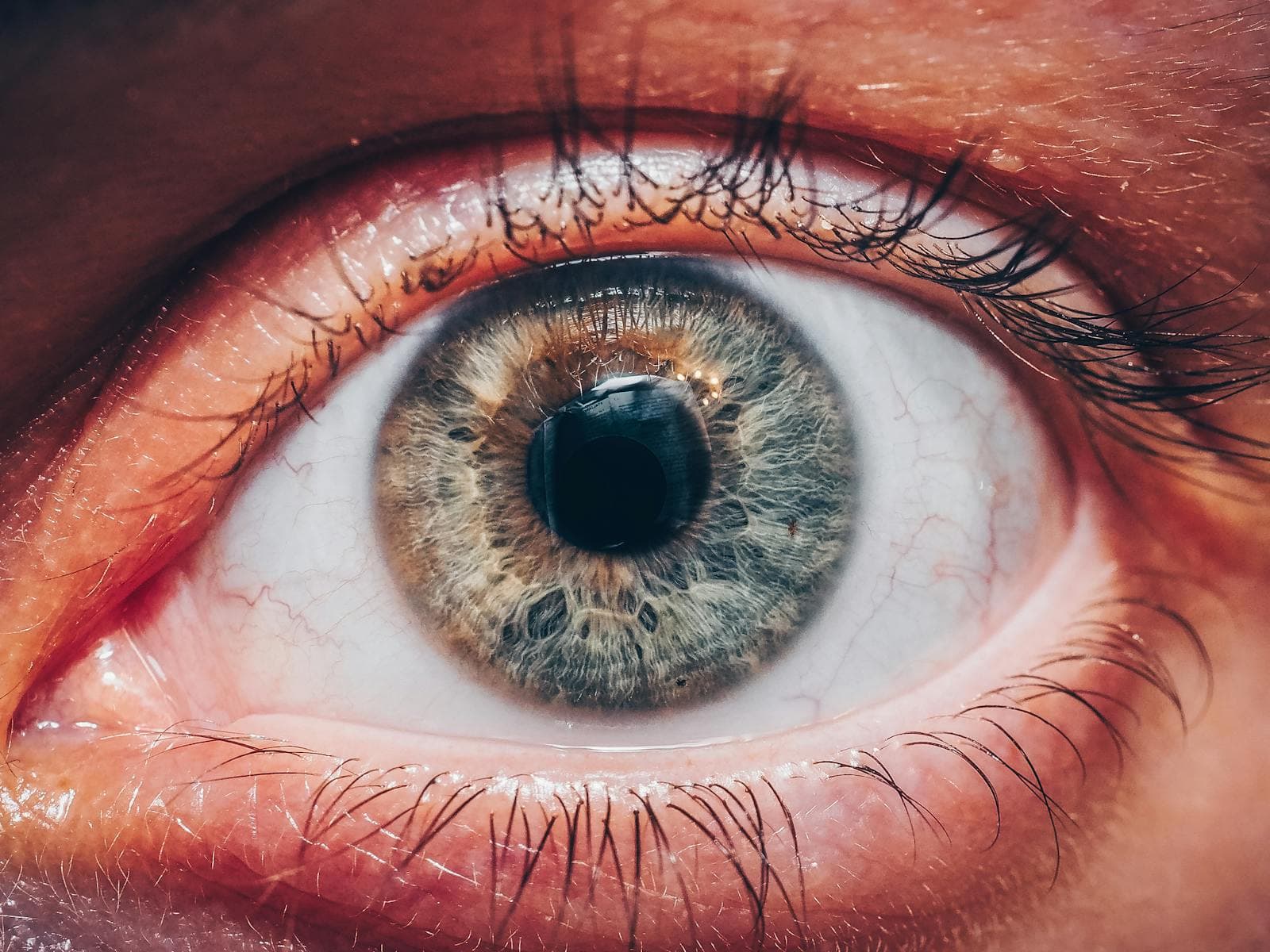 What Is Macular Degeneration? A Complete Guide