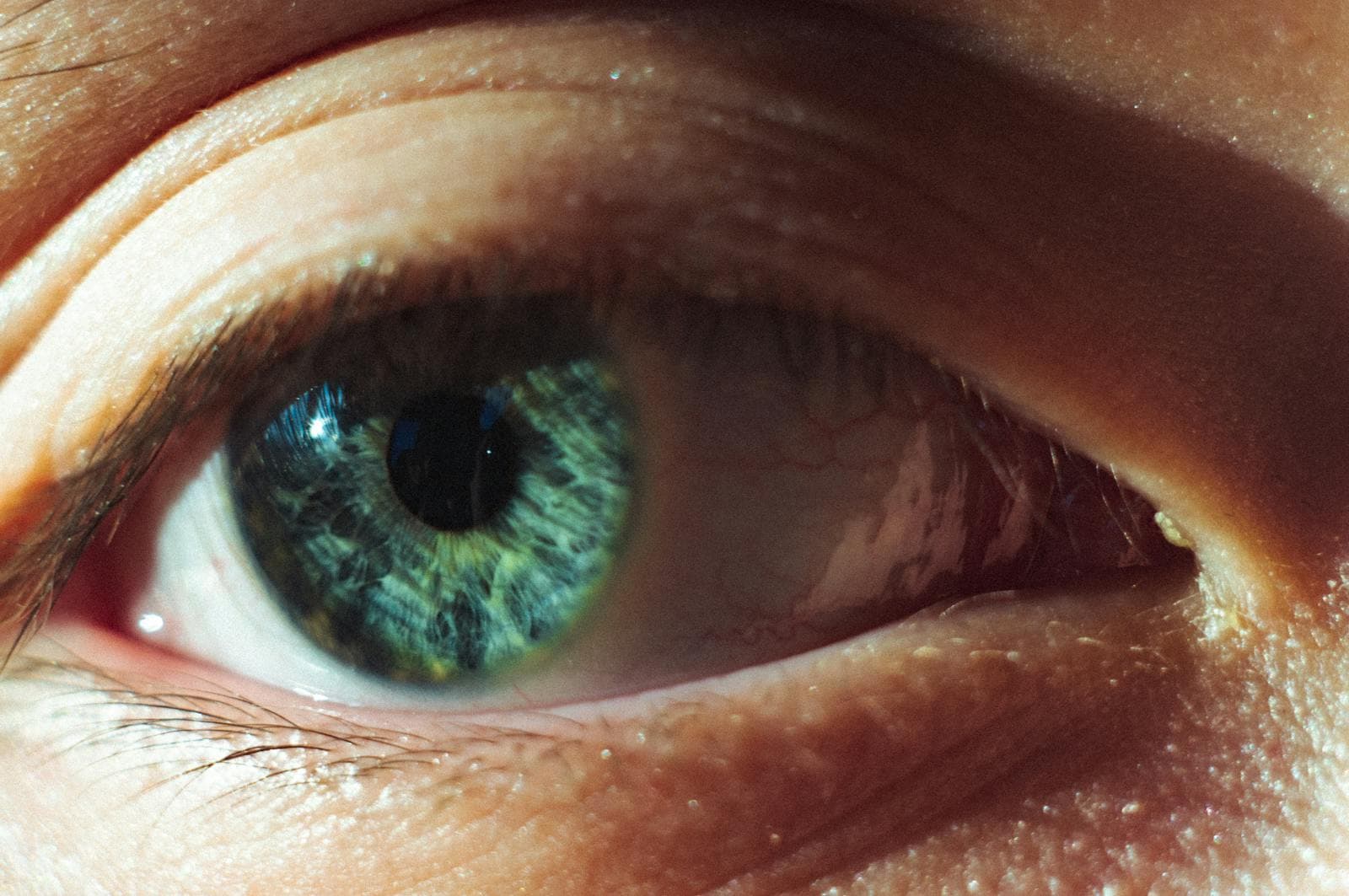 Retinal Tear Warning Signs: Don't Ignore These Symptoms